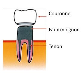 COURONNE